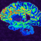Imagen para el artículo titulado Los monos anestesiados se despiertan al instante cuando los investigadores estimulan la región cerebral vinculada a la conciencia